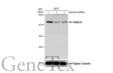 Anti-HDAC8 antibody [N1C2] used in Western Blot (WB). GTX105074