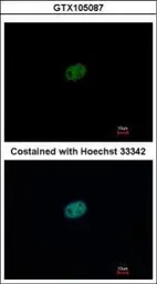 Anti-RFC2 antibody used in Immunocytochemistry/ Immunofluorescence (ICC/IF). GTX105087