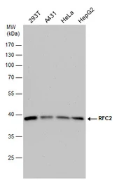 Anti-RFC2 antibody used in Western Blot (WB). GTX105087