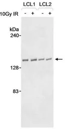 Anti-RENT1 antibody used in Western Blot (WB). GTX10510