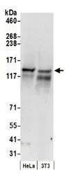 Anti-RENT1 antibody used in Western Blot (WB). GTX10510