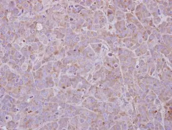 Anti-MAGEB1 antibody used in IHC (Paraffin sections) (IHC-P). GTX105112