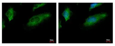 Anti-CoCoA antibody [N2C2], Internal used in Immunocytochemistry/ Immunofluorescence (ICC/IF). GTX105118