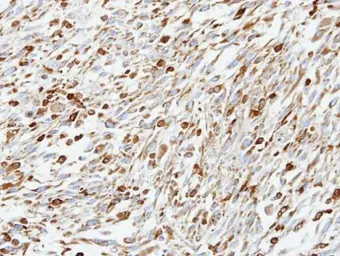Anti-CoCoA antibody [N2C2], Internal used in IHC (Paraffin sections) (IHC-P). GTX105118