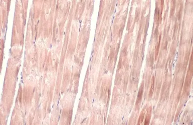 Anti-OGDH antibody [C2C3], C-term used in IHC (Paraffin sections) (IHC-P). GTX105124