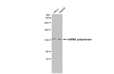 Anti-mtRNA polymerase antibody [N2N3] used in Western Blot (WB). GTX105137