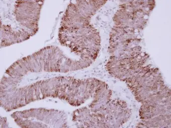 Anti-OTC antibody used in IHC (Paraffin sections) (IHC-P). GTX105140