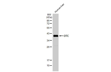 Anti-OTC antibody used in Western Blot (WB). GTX105140
