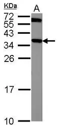 Anti-CRYM antibody [N1C3] used in Western Blot (WB). GTX105145