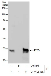 Anti-ETFA antibody used in Immunoprecipitation (IP). GTX105155