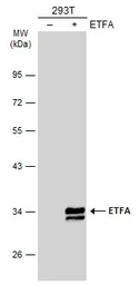 Anti-ETFA antibody used in Western Blot (WB). GTX105155