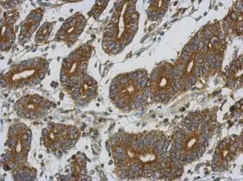 Anti-ETFA antibody used in IHC (Paraffin sections) (IHC-P). GTX105155