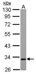 Anti-ETFA antibody used in Western Blot (WB). GTX105155