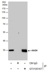 Anti-HADH antibody used in Immunoprecipitation (IP). GTX105167
