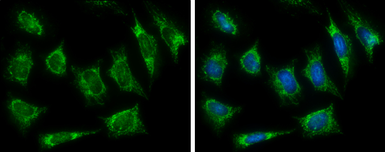 Anti-HADH antibody used in Immunocytochemistry/ Immunofluorescence (ICC/IF). GTX105167