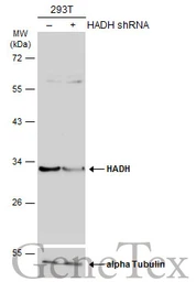 Anti-HADH antibody used in Western Blot (WB). GTX105167