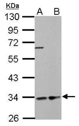 Anti-HADH antibody used in Western Blot (WB). GTX105167