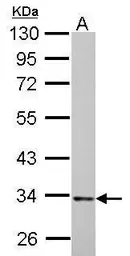 Anti-HADH antibody used in Western Blot (WB). GTX105167