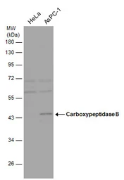 Anti-Carboxypeptidase B antibody [N1C1] used in Western Blot (WB). GTX105170