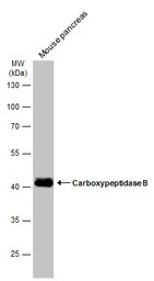 Anti-Carboxypeptidase B antibody [N1C1] used in Western Blot (WB). GTX105170