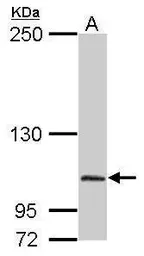 Anti-DPRP1 antibody [N3C2], Internal used in Western Blot (WB). GTX105200