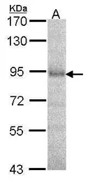 Anti-DPRP1 antibody [N3C2], Internal used in Western Blot (WB). GTX105200