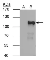 Anti-OCT1 antibody used in Immunoprecipitation (IP). GTX105202