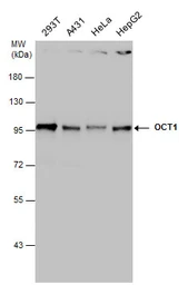 Anti-OCT1 antibody used in Western Blot (WB). GTX105202