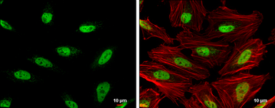 Anti-OCT1 antibody used in Immunocytochemistry/ Immunofluorescence (ICC/IF). GTX105202