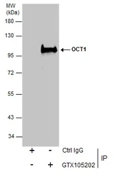 Anti-OCT1 antibody used in Immunoprecipitation (IP). GTX105202