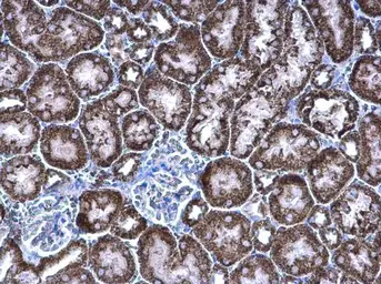 Anti-PCCB antibody [N2C3] used in IHC (Paraffin sections) (IHC-P). GTX105204