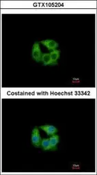 Anti-PCCB antibody [N2C3] used in Immunocytochemistry/ Immunofluorescence (ICC/IF). GTX105204