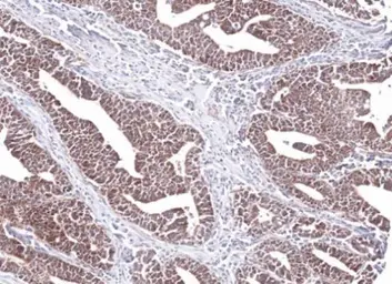 Anti-PCCB antibody [N2C3] used in IHC (Paraffin sections) (IHC-P). GTX105204