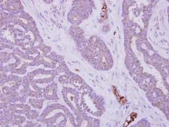 Anti-MTMR14 antibody used in IHC (Paraffin sections) (IHC-P). GTX105206