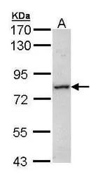 Anti-MTMR14 antibody used in Western Blot (WB). GTX105206