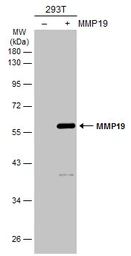 Anti-MMP19 antibody used in Western Blot (WB). GTX105217