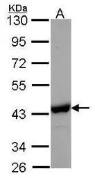 Anti-NANS antibody [N1C3] used in Western Blot (WB). GTX105223