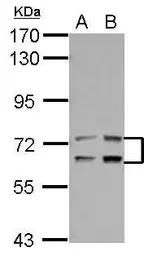 Anti-LTA4H antibody used in Western Blot (WB). GTX105239