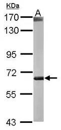 Anti-CROT antibody [N2C2], Internal used in Western Blot (WB). GTX105243