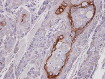 Anti-CROT antibody [N2C2], Internal used in IHC (Paraffin sections) (IHC-P). GTX105243