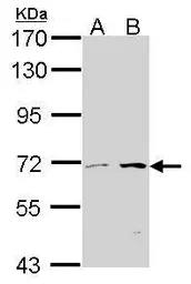Anti-CROT antibody [N2C2], Internal used in Western Blot (WB). GTX105243