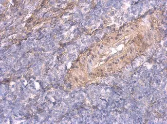 Anti-TNFAIP2 antibody [C1C3] used in IHC (Paraffin sections) (IHC-P). GTX105256