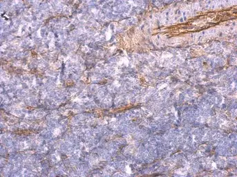 Anti-TNFAIP2 antibody [C1C3] used in IHC (Paraffin sections) (IHC-P). GTX105256