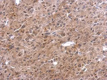 Anti-TNFAIP2 antibody [C1C3] used in IHC (Paraffin sections) (IHC-P). GTX105256