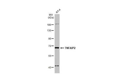 Anti-TNFAIP2 antibody [C1C3] used in Western Blot (WB). GTX105256