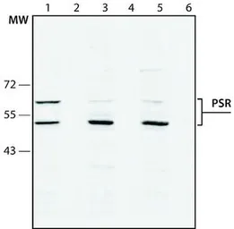 Anti-PSR antibody used in Western Blot (WB). GTX10526