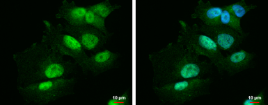 Anti-PBX1 antibody [N2C3] used in Immunocytochemistry/ Immunofluorescence (ICC/IF). GTX105260