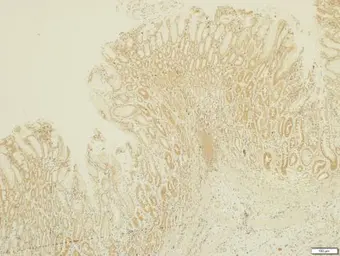 Anti-MMP17 antibody [N2C2], Internal used in IHC (Paraffin sections) (IHC-P). GTX105268
