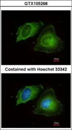 Anti-MMP17 antibody [N2C2], Internal used in Immunocytochemistry/ Immunofluorescence (ICC/IF). GTX105268