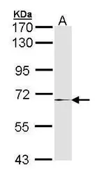Anti-MMP17 antibody [N2C2], Internal used in Western Blot (WB). GTX105268